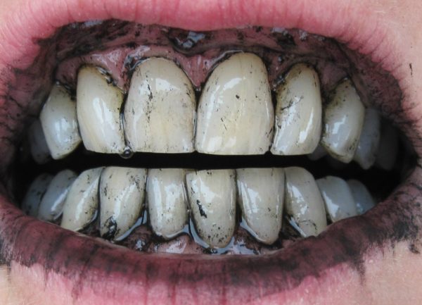 Чистка зубов активированным углем.