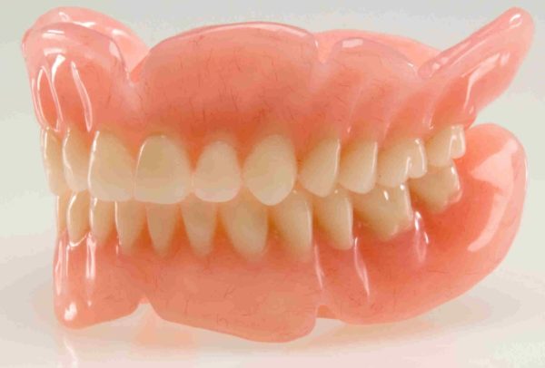 Вид съемного зубного протеза.